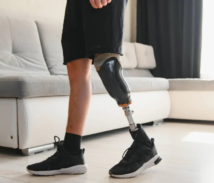 lower-limb-prosthesis-what-you-need-to-know-1920px-1920w