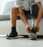 man-amputee-prosthetic-leg-disability-600nw-2520889277