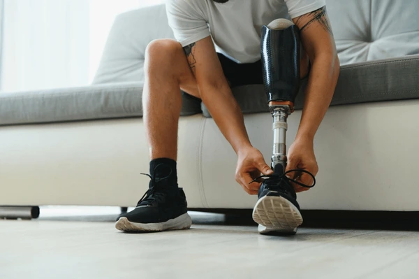 man-amputee-prosthetic-leg-disability-600nw-2520889277